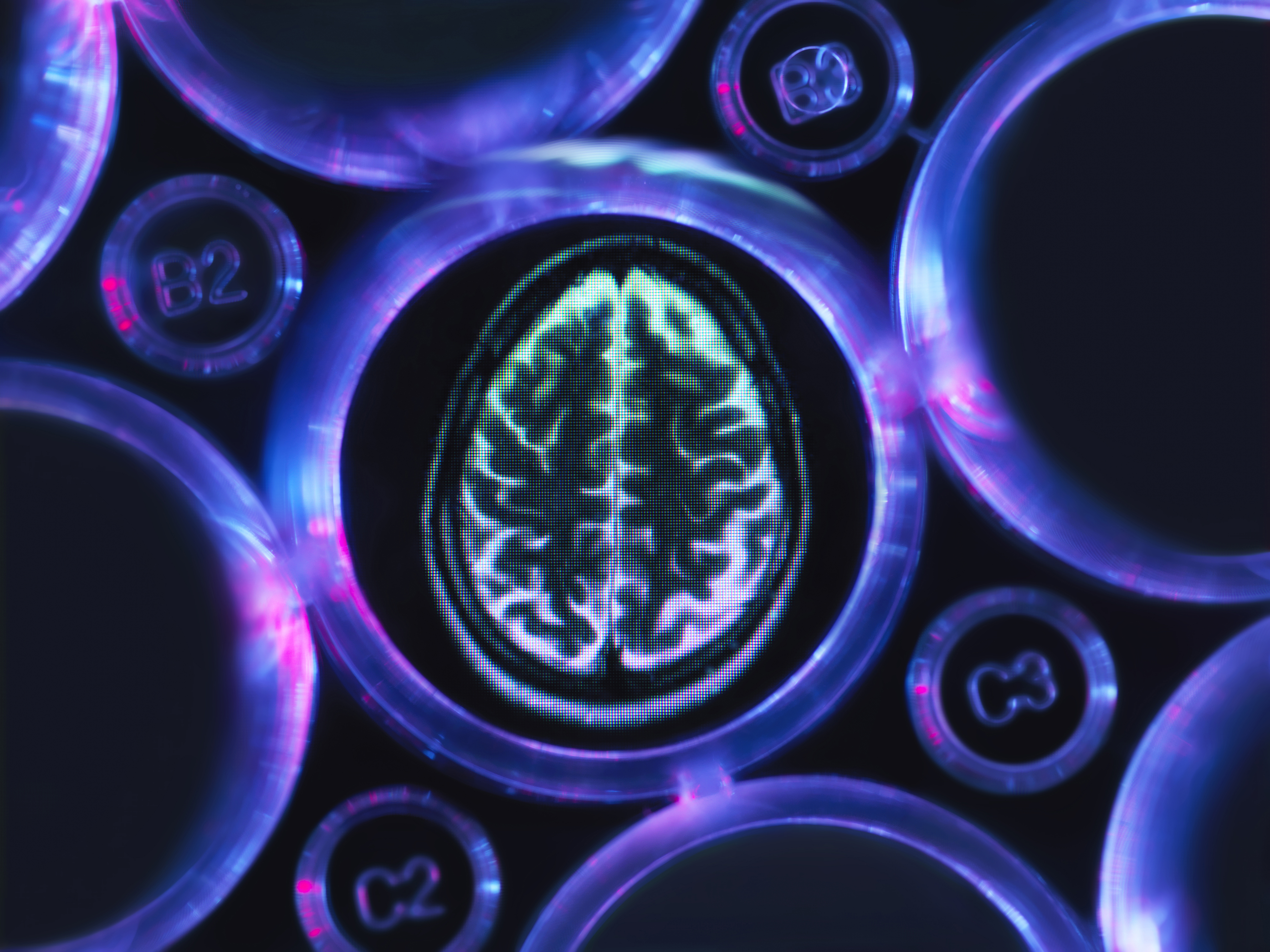 Alzheimers and dementia research, a brain scan in multi well tray used for research experiments in laboratory