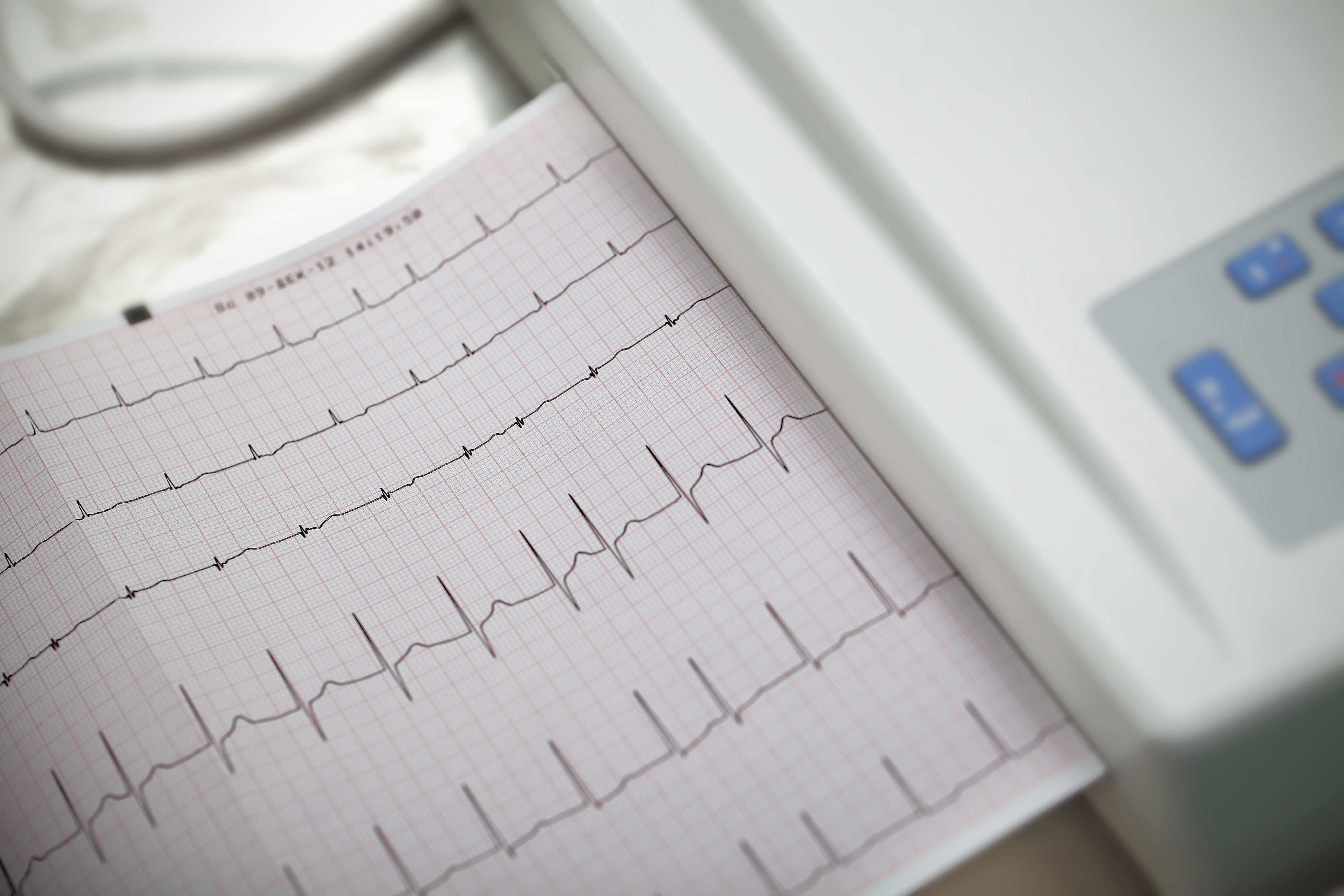 Cardiography. Method in medicine.