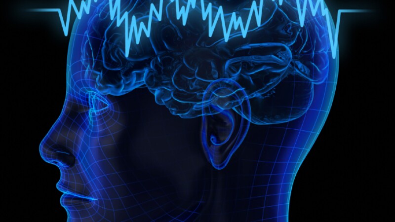 The human brain